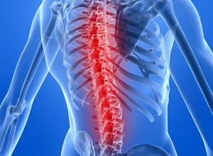 Bị bạn nhảy lên lưng, chàng trai trượt đĩa đệm